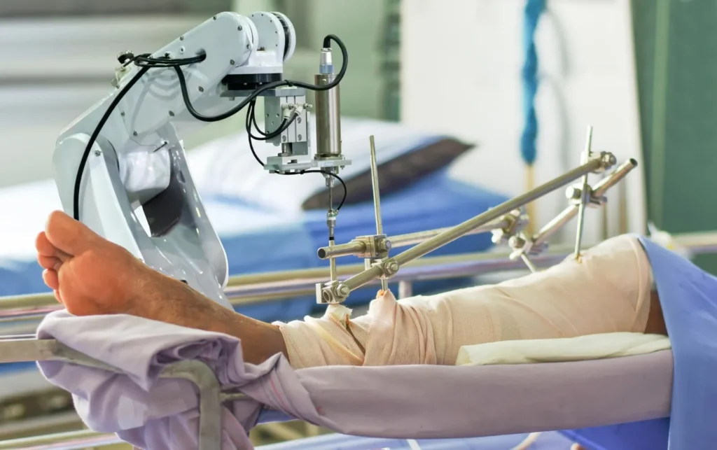 Robotic Knee Replacement